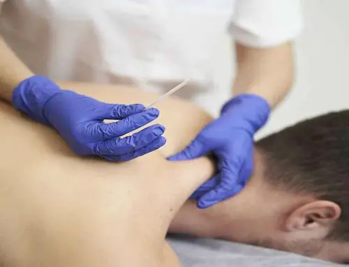 Can Massage Therapists Do Dry Needling